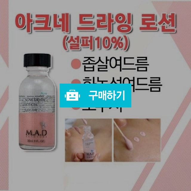 여드름,트러블 핑크스팟 (등드름 / 가드름) 항염/ 소독/진정 / 슈실장의 뷰티랩 / 디비디비 / 구매하기 / 특가할인